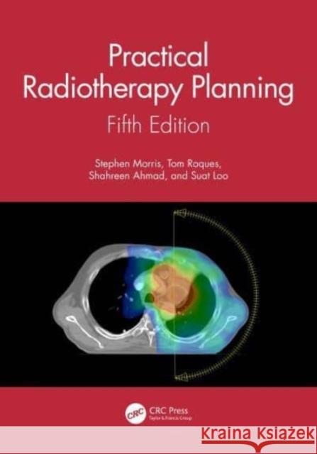 Practical Radiotherapy Planning: Fifth Edition Morris, Stephen 9781138045989 TAYLOR & FRANCIS