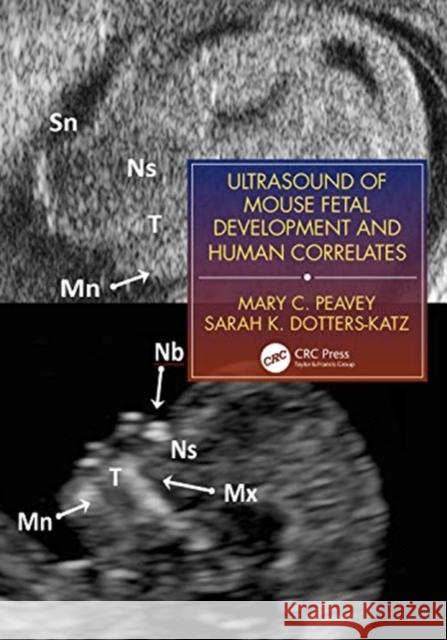 Ultrasound of Mouse Fetal Development and Human Correlates Peavey, Mary C. 9781138071216 CRC Press