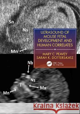 Ultrasound of Mouse Fetal Development and Human Correlates Peavey, Mary C. 9781138071247 CRC Press