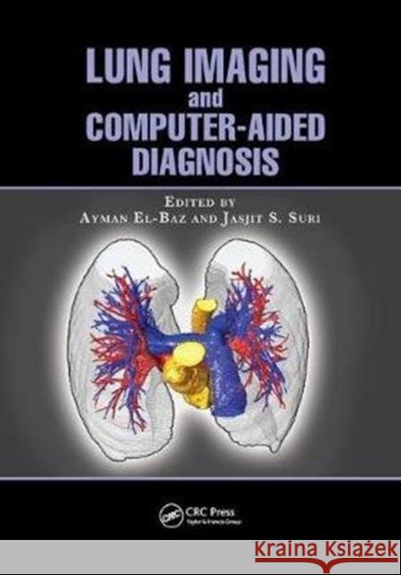 Lung Imaging and Computer Aided Diagnosis  9781138072077 