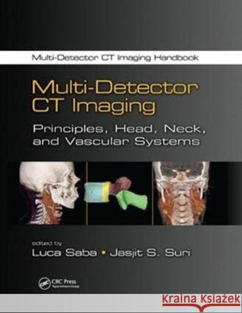 Multi-Detector CT Imaging: Principles, Head, Neck, and Vascular Systems  9781138076488 