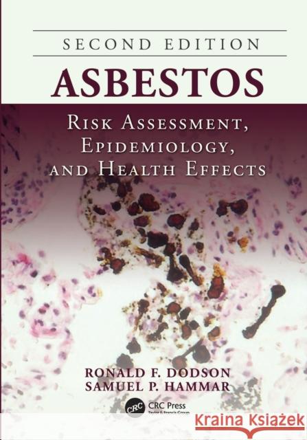 Asbestos: Risk Assessment, Epidemiology, and Health Effects, Second Edition  9781138076709 