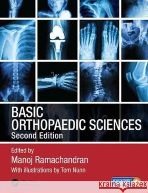 Basic Orthopaedic Sciences Ramachandran, Manoj 9781138091726 CRC Press