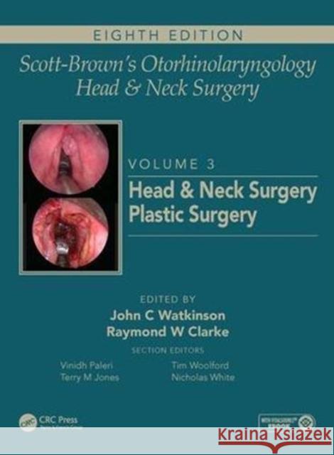 Scott-Brown's Otorhinolaryngology and Head and Neck Surgery: Volume 3: Head and Neck Surgery, Plastic Surgery [With eBook] Watkinson, John 9781138094642