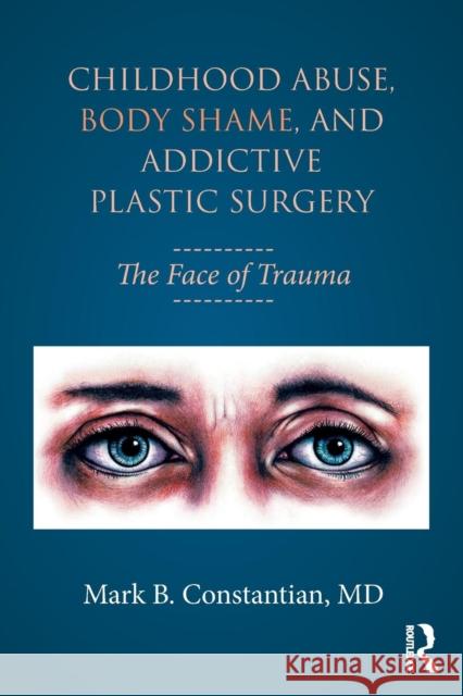 Childhood Abuse, Body Shame, and Addictive Plastic Surgery: The Face of Trauma Constantian, Mark B. 9781138100312 Routledge