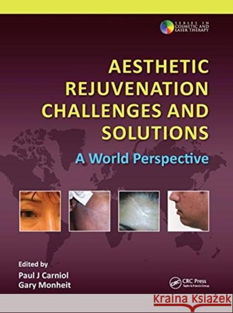 Aesthetic Rejuvenation Challenges and Solutions: A World Perspective Paul J. Carniol Gary D. Monheit 9781138112049 CRC Press