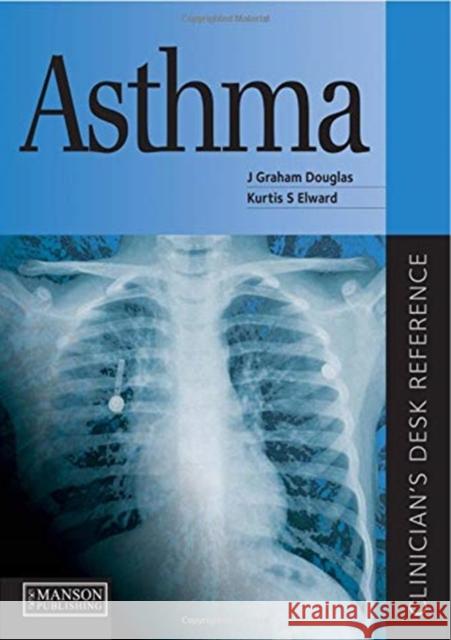 Asthma J. Graham Douglas Kurtis S. Elward 9781138113466