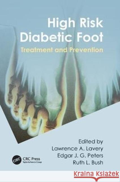 High Risk Diabetic Foot: Treatment and Prevention Lawrence A. Lavery, Edgar J G. Peters, Ruth Bush 9781138114159