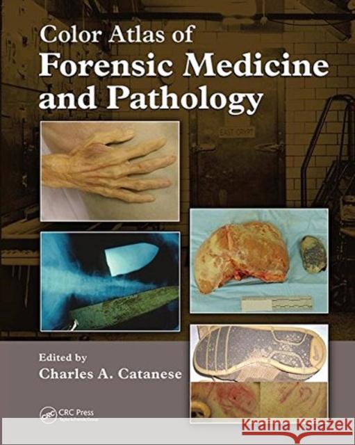 Color Atlas of Forensic Medicine and Pathology  9781138114876 