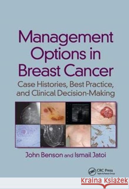 Management Options in Breast Cancer: Case Histories, Best Practice, and Clinical Decision-Making John Benson Ismail Jatoi  9781138115026 CRC Press