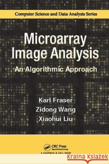 Microarray Image Analysis: An Algorithmic Approach Karl Fraser (Brunel University, Uxbridge Zidong Wang (Brunel University London, U Xiaohui Liu (Brunel University, Uxbrid 9781138115156 CRC Press