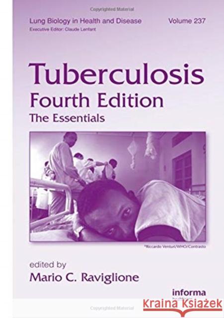 Tuberculosis: The Essentials, Fourth Edition Mario C. Raviglione (World Health Organi   9781138117662