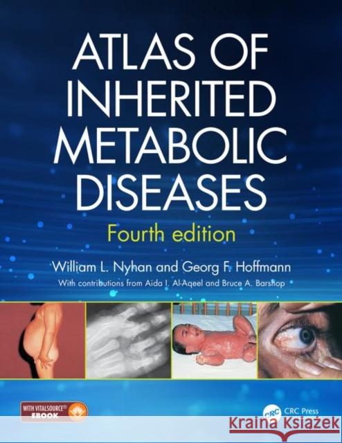 Atlas of Inherited Metabolic Diseases Nyhan, William L. 9781138196599 CRC Press