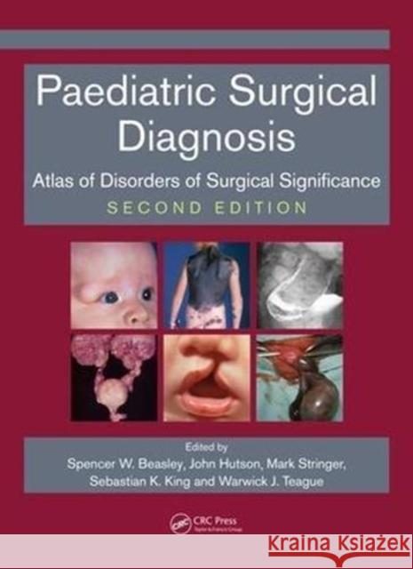 Paediatric Surgical Diagnosis: Atlas of Disorders of Surgical Significance, Second Edition Spencer Beasley John Hutson Mark D. Stringer 9781138197329