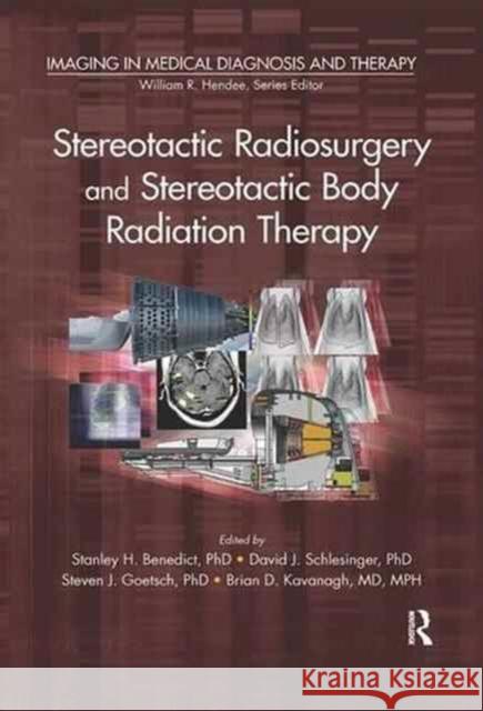 Stereotactic Radiosurgery and Stereotactic Body Radiation Therapy Stanley H. Benedict David J. Schlesinger Steven J. Goetsch 9781138198548