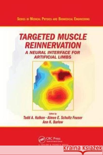 Targeted Muscle Reinnervation: A Neural Interface for Artificial Limbs Todd A. Kuiken, Aimee E. Schultz Feuser, Ann K. Barlow 9781138198647