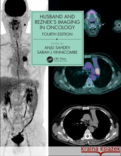 Husband & Reznek's Imaging in Oncology Sahdev, Anju 9781138301238 CRC Press