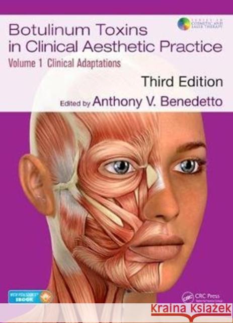 Botulinum Toxins in Clinical Aesthetic Practice 3e, Volume One: Clinical Adaptations [With eBook] Benedetto, Anthony V. 9781138301849