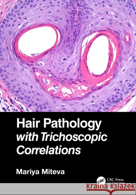 Hair Pathology with Trichoscopic Correlations Mariya Miteva 9781138313538 CRC Press