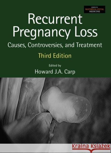 Recurrent Pregnancy Loss: Causes, Controversies, and Treatment Carp, Howard 9781138325654 CRC Press