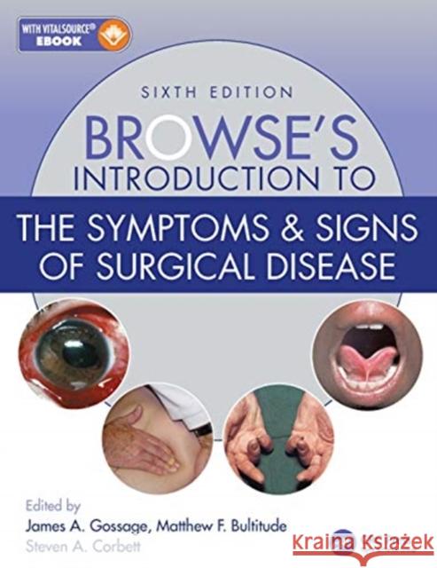 Browse's Introduction to the Symptoms & Signs of Surgical Disease Steven A. Corbett Matthew Bultitude James A. Gossage 9781138330085