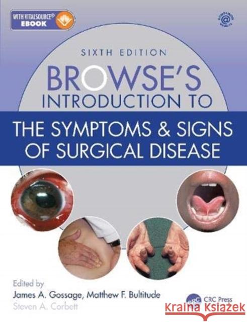 Browse's Introduction to the Symptoms & Signs of Surgical Disease Steven A. Corbett Matthew Bultitude James A. Gossage 9781138330405