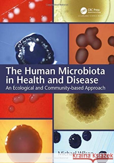 The Human Microbiota in Health and Disease: An Ecological and Community-Based Approach Mike Wilson (UCL Eastman Dental Institut   9781138342781 CRC Press