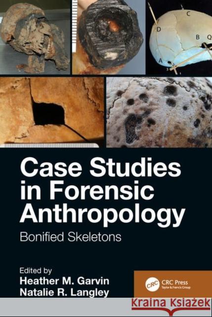 Case Studies in Forensic Anthropology: Bonified Skeletons Heather M. Garvin Natalie R. Langley 9781138347656