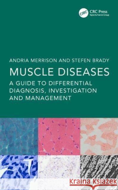 Muscle Diseases  9781138368026 Taylor & Francis Ltd