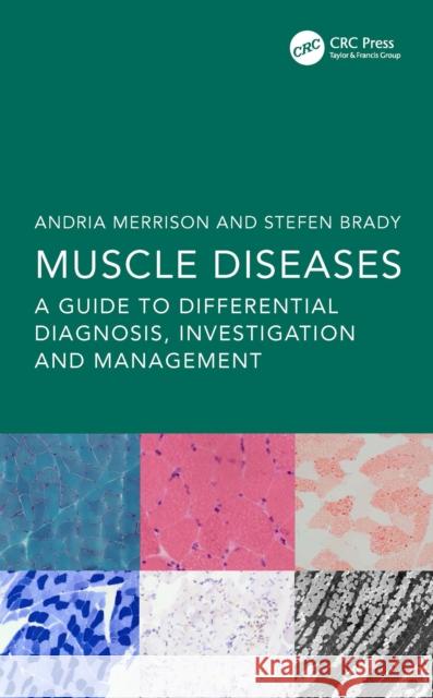 Muscle Diseases: A Guide to Differential Diagnosis, Investigation and Management  9781138368330 Taylor & Francis Ltd