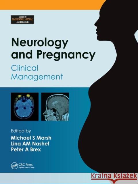 Neurology and Pregnancy: Clinical Management Marsh, Michael S. 9781138372474