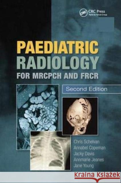 Paediatric Radiology for Mrcpch and Frcr, Second Edition Christopher Schelvan Annabel Copeman Jane Young 9781138372887