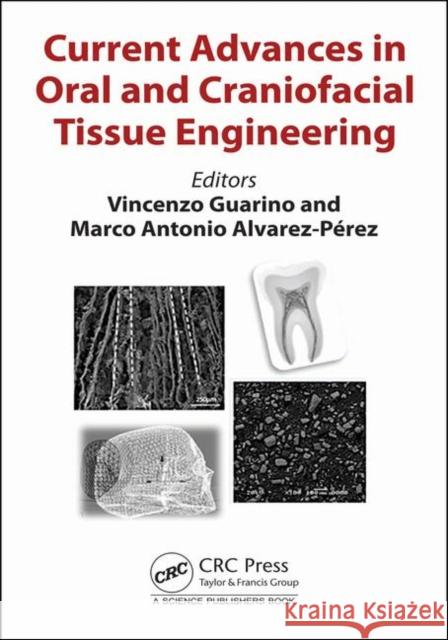 Current Advances in Oral and Craniofacial Tissue Engineering Vincenzo Guarino Marco Antonio Alverez-Perez 9781138390911