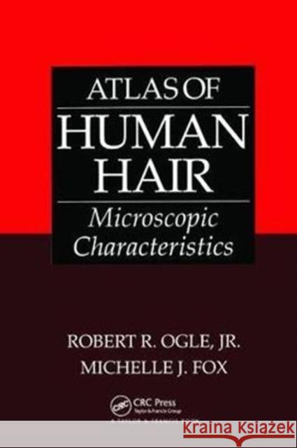 Atlas of Human Hair: Microscopic Characteristics Jr. Ogle, Michelle J. Fox 9781138426993 Taylor & Francis Ltd