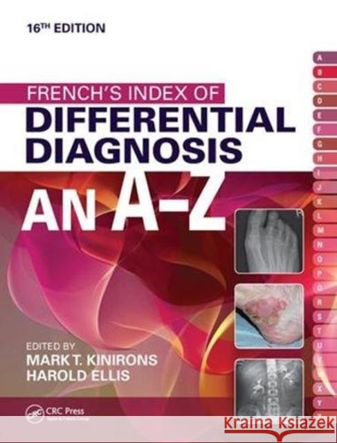French's Index of Differential Diagnosis an A-Z Kinirons, Mark T. 9781138445123 CRC Press