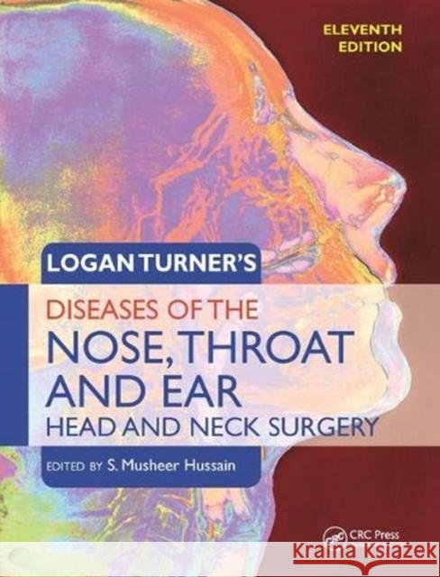 Logan Turner's Diseases of the Nose, Throat and Ear: Head and Neck Surgery, 11th Edition  9781138456372 Taylor and Francis