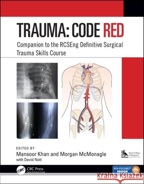 Trauma: Code Red: Companion to the Rcseng Definitive Surgical Trauma Skills Course Mansoor Khan Morgan McMonagle 9781138477018 CRC Press