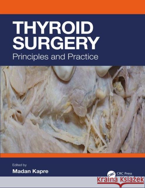 Thyroid Surgery: Principles and Practice Madan Laxman Kapre 9781138483781 CRC Press