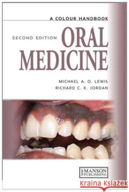 Oral Medicine Lewis, Michael 9781138494183 CRC Press