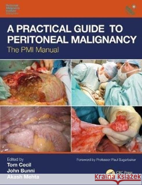 A Practical Guide to Peritoneal Malignancy: The PMI Manual Tom Cecil John Bunni Akash Mehta 9781138495050 CRC Press