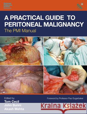 A Practical Guide to Peritoneal Malignancy: The PMI Manual Tom Cecil John Bunni Akash Mehta 9781138495111 