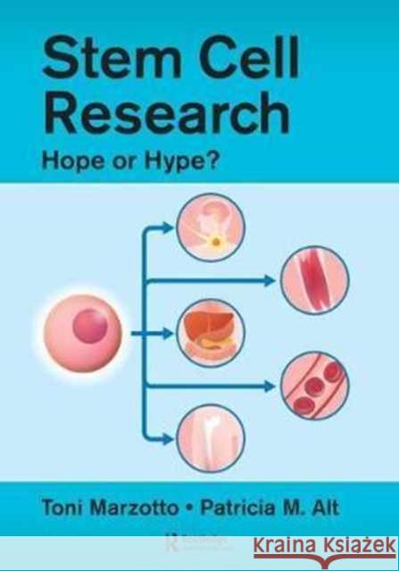 Stem Cell Research: Hope or Hype? Patricia M. Alt Toni Marzotto Linda Caplis 9781138627291 CRC Press