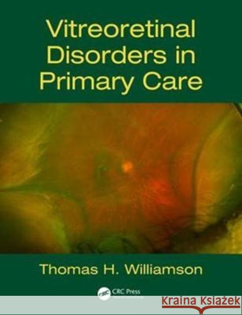 Vitreoretinal Disorders in Primary Care Williamson, Thomas H. (St Thomas Hospital, Lambeth Palace Road, London, SE1 7FH, UK) 9781138628113