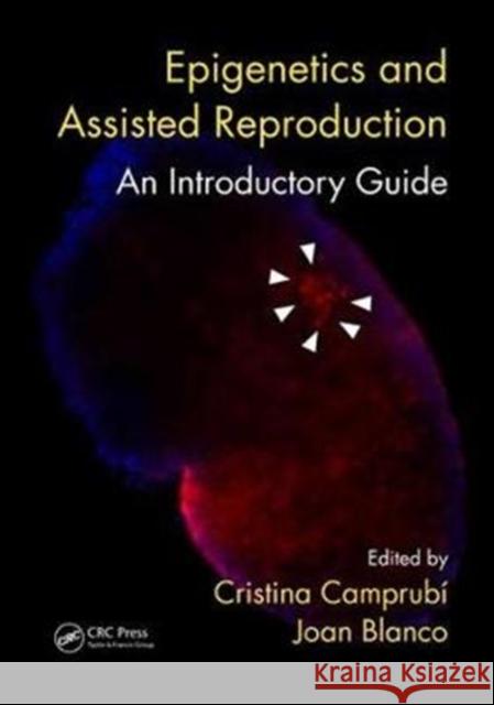 Epigenetics and Assisted Reproduction: An Introductory Guide Cristina Camprubai Joan Blanco 9781138631632 CRC Press