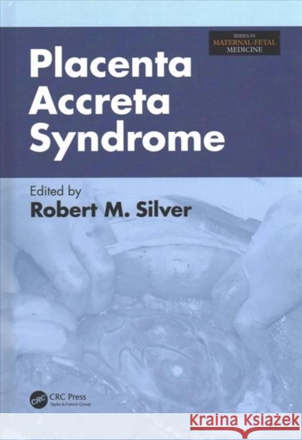 Placenta Accreta Syndrome  9781138703551 Taylor and Francis