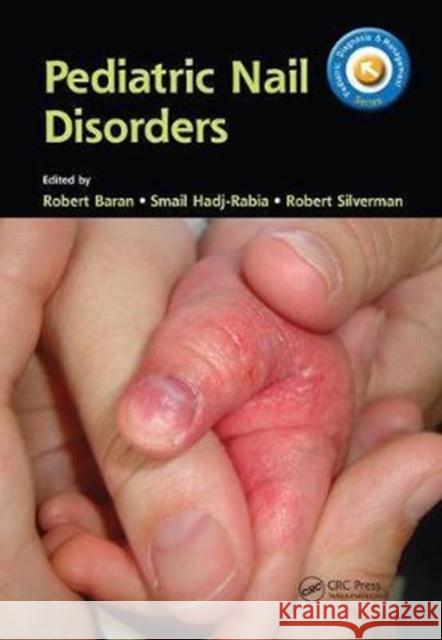 Pediatric Nail Disorders Robert Baran Smail Hadj-Rabia Robert Silverman 9781138704343 CRC Press