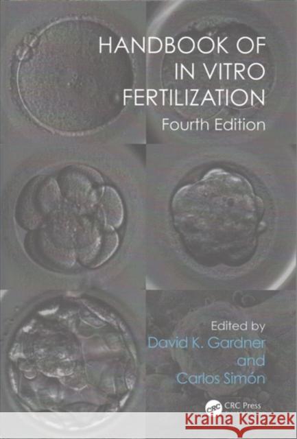 Handbook of in Vitro Fertilization David K. Gardner Carlos Simon 9781138704374 CRC Press