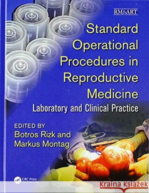 Standard Operational Procedures in Reproductive Medicine: Laboratory and Clinical Practice Botros Rizk Markus Montag 9781138704527 CRC Press