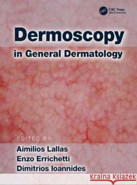 Dermoscopy in General Dermatology Aimilios Lallas Enzo Errichetti Dimitrios Ioannides 9781138706569