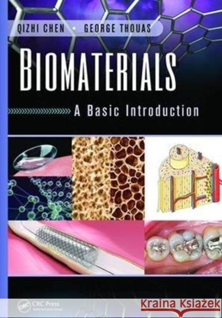 Biomaterials: A Basic Introduction Qizhi Chen George Thouas 9781138749665 CRC Press